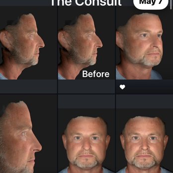 Jacob Sedgh, MD - My consultation - Cosmetic Surgeons Near Me - West Hollywood, California