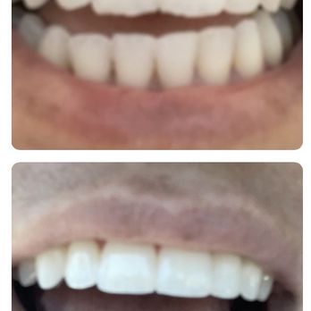 Floss - Cosmetic Dentists Near Me - San Diego, California