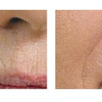 Gene Rubinstein, MD, FAAD - Dermatologists Near Me - Studio City, California Gene Rubinstein, MD, FAAD - Dermatologists Near Me - Studio City, California