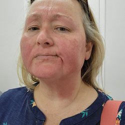 Rio Body Wax - Douglasville - It feels like it looks! I normally enjoy having my full face waxed.