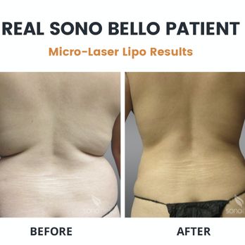 Sono Bello - Cosmetic Surgeons Near Me - Tampa, Florida Sono Bello - Cosmetic Surgeons Near Me - Tampa, Florida