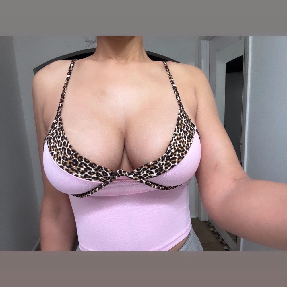 Barrett Plastic Surgery - Dr. Neusner's work. Ref: 5'8 505cc mod plus - Cosmetic Surgeons Near Me - Beverly Hills, California