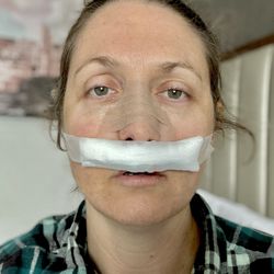 Nasal & Sinus Center: Parul Goyal, MD - Post op immediately