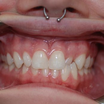 Smileodontics - Orthodontists Near Me - Mason, Ohio Smileodontics - Orthodontists Near Me - Mason, Ohio