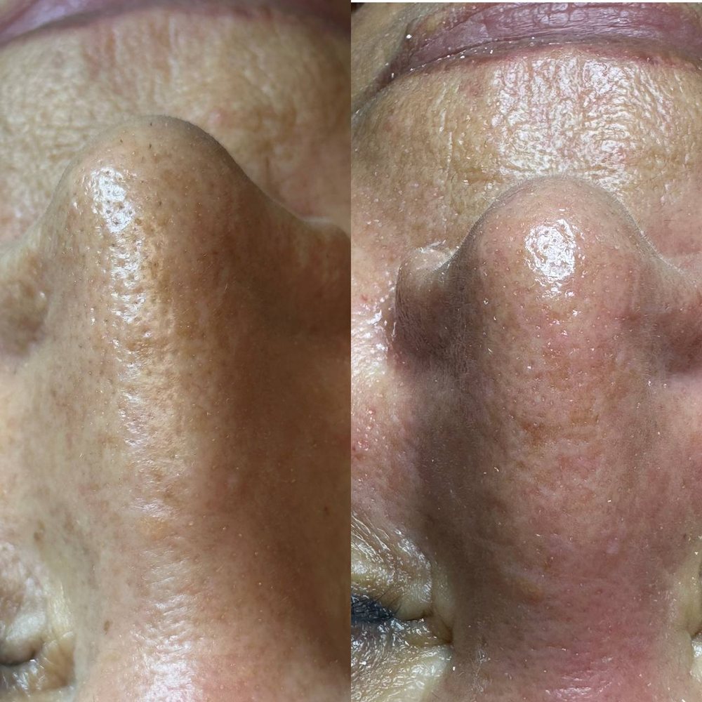 Dermalex facial by setare Logo
