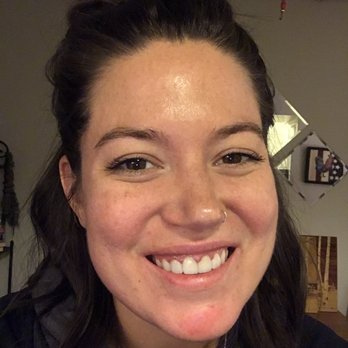 Sunset Plaza Dental - The day I received my permanent teeth. Still swollen and bruised a little but will be good as new in a week!!!! - General Dentistry Near Me - West Hollywood, California