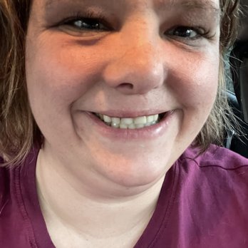 Signature Dental - After my work from Dr. Modi - Cosmetic Dentists Near Me - Modesto, California Signature Dental - After my work from Dr. Modi - Cosmetic Dentists Near Me - Modesto, California