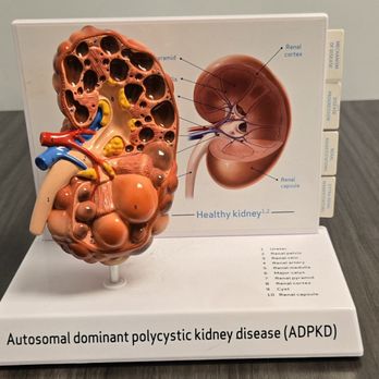 Memphis Kidney and Hypertension - Nephrologists Near Me - Germantown, Tennessee Memphis Kidney and Hypertension - Nephrologists Near Me - Germantown, Tennessee