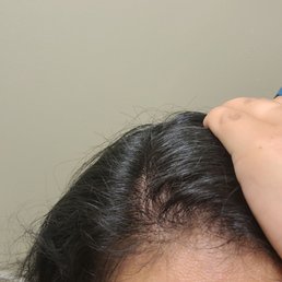 All around short hair. Not even hair products can hold this down