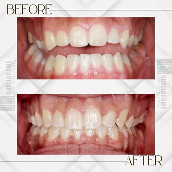 Burlingame Smile Studio - Orthodontists Near Me - Burlingame, California Burlingame Smile Studio - Orthodontists Near Me - Burlingame, California