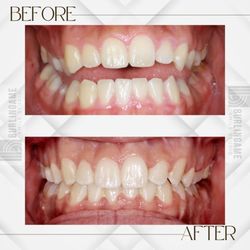 Burlingame Smile Studio
