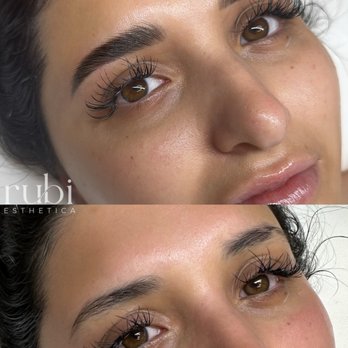 Rubi Esthetica - Skin Care Near Me - Phoenix, Arizona Rubi Esthetica - Skin Care Near Me - Phoenix, Arizona