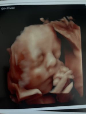 MOMMY AND ME 3D 4D ULTRASOUND - Updated July 2026 - 291 Photos & 580 ...