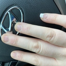 The three nails that popped off and you can see on my pinky the acrylic lifting off my nail bed.