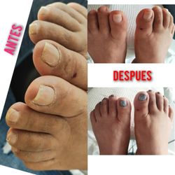 Spa Las Glorias - Before/ after      Deep pedicure