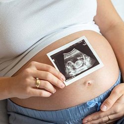 Beautiful Beginnings Ultrasound