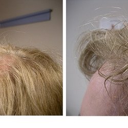 Well Rooted Hair And Scalp Clinic - Before and After