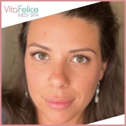 Vita Felice Medi Spa - Healed Powder Brows
