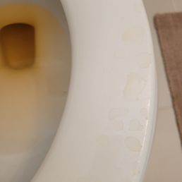 The image shows a white toilet seat with visible water stains and discoloration on its surface, taken in a bathroom setting.