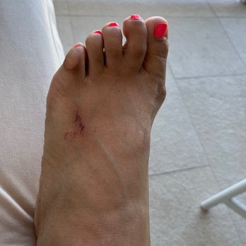 AV Nails and Spa - Scar on my foot from the pedicure 2 days prior to the photo - Nail Salons Near Me - Silver Spring, Maryland