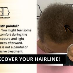 Scalp Ink Design