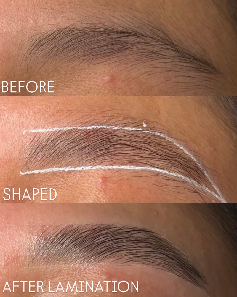 The Brow Rehab Center Logo