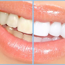 Lash Envy Design - In 15 minutes you can get 2-5 shades lighter!