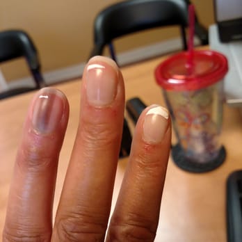 Pink Nails 88 Day Spa - Day 5...cuticles red and hurting - Nail Salons Near Me - Williamsburg, Virginia Pink Nails 88 Day Spa - Day 5...cuticles red and hurting - Nail Salons Near Me - Williamsburg, Virginia