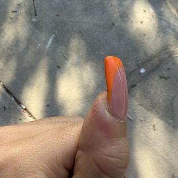 Euro Nails & Spa - Fungus infected thumb - Nail Salons Near Me - Kissimmee, Florida