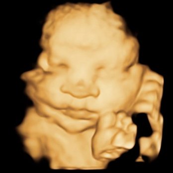 4D Miracles - Baby Bliss 4D - Ultrasound Imaging Centers Near Me - Fremont, California 4D Miracles - Baby Bliss 4D - Ultrasound Imaging Centers Near Me - Fremont, California