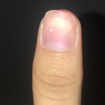 Nails By Long - Uneven and bloody. - Nail Salons Near Me - San Diego, California Nails By Long - Uneven and bloody. - Nail Salons Near Me - San Diego, California