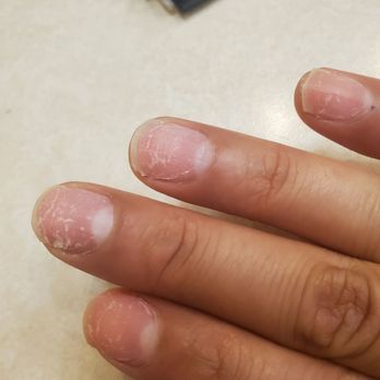 Lucky Corner Nails Spa & Waxing - Nails after removing - Waxing Near Me - Hawthorne, California