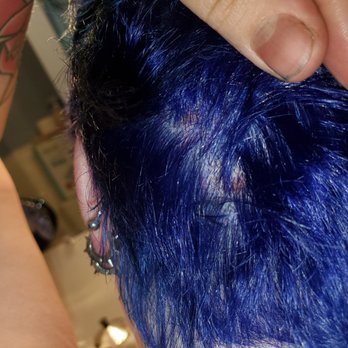 The Ultimate Salon  - Chemical burns - Waxing Near Me - La Crosse, Wisconsin