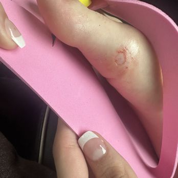 Harmony Nails & Spa - they used new sponges on the feet to scrub and he pretty rough which caused this to happen and cuts on her feet.. - Nail Salons Near Me - Chapin, South Carolina Harmony Nails & Spa - they used new sponges on the feet to scrub and he pretty rough which caused this to happen and cuts on her feet.. - Nail Salons Near Me - Chapin, South Carolina