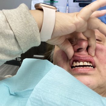 Bobby Jivnani Plano Dental - I cried when I saw this, I was embarrassed to smile bc my teeth were missing and some in very bad condition. - Oral Surgeons Near Me - Plano, Texas