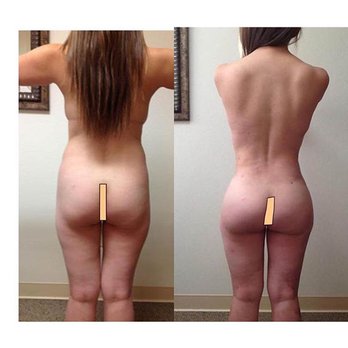 Kimberly Henry, MD - Butt Augmentation - Cosmetic Surgeons Near Me - Greenbrae, California Kimberly Henry, MD - Butt Augmentation - Cosmetic Surgeons Near Me - Greenbrae, California