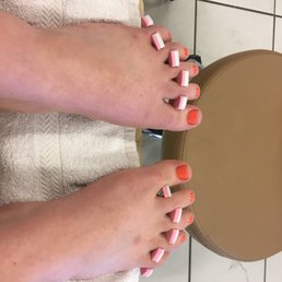 Successful pedicure Successful pedicure