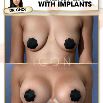 Icon Cosmetic Center - Cosmetic Surgeons Near Me - Miami, Florida Icon Cosmetic Center - Cosmetic Surgeons Near Me - Miami, Florida
