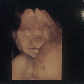 Unique Ultrasound - My sweet baby boy. - Diagnostic Imaging Near Me - Temecula, California Unique Ultrasound - My sweet baby boy. - Diagnostic Imaging Near Me - Temecula, California