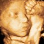 Photo of Diagnostic Ultrasound Suite