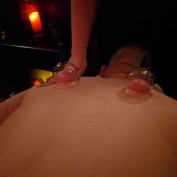 Massage Therafix - Cupping releases adhesions and increases bloodflow. - Massage Near Me - Pawcatuck, Connecticut Massage Therafix - Cupping releases adhesions and increases bloodflow. - Massage Near Me - Pawcatuck, Connecticut