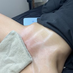 My sugar wax results after the first time My sugar wax results after the first time