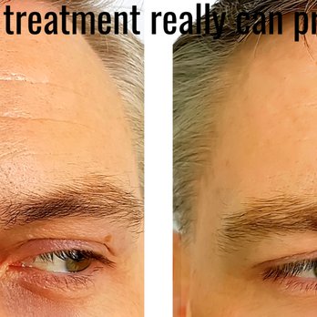 Ultra Smooth Skin - Medical Spas Near Me - Chandler, Arizona Ultra Smooth Skin - Medical Spas Near Me - Chandler, Arizona