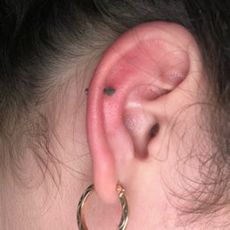 I got a low helix piercing I got a low helix piercing