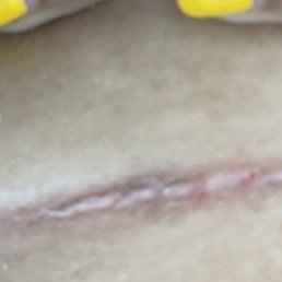 my left side above my private area