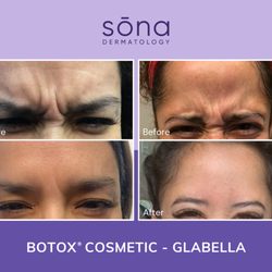 Sona Dermatology of Lake Norman