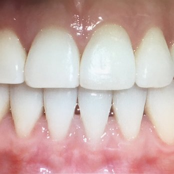Lee Orthodontics: David Lee, DDS, MSD - Orthodontists Near Me - Concord, California Lee Orthodontics: David Lee, DDS, MSD - Orthodontists Near Me - Concord, California