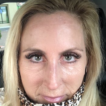 Armstrong MD - After - Dermatologists Near Me - Newport Beach, California