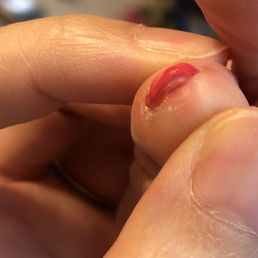 Cut underneath my pinky toe