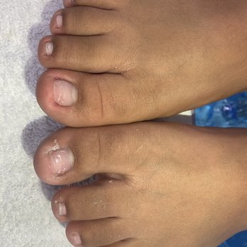Organic Nails & Spa - In-grown nail removal procedure. - Nail Salons Near Me - Clermont, Florida Organic Nails & Spa - In-grown nail removal procedure. - Nail Salons Near Me - Clermont, Florida